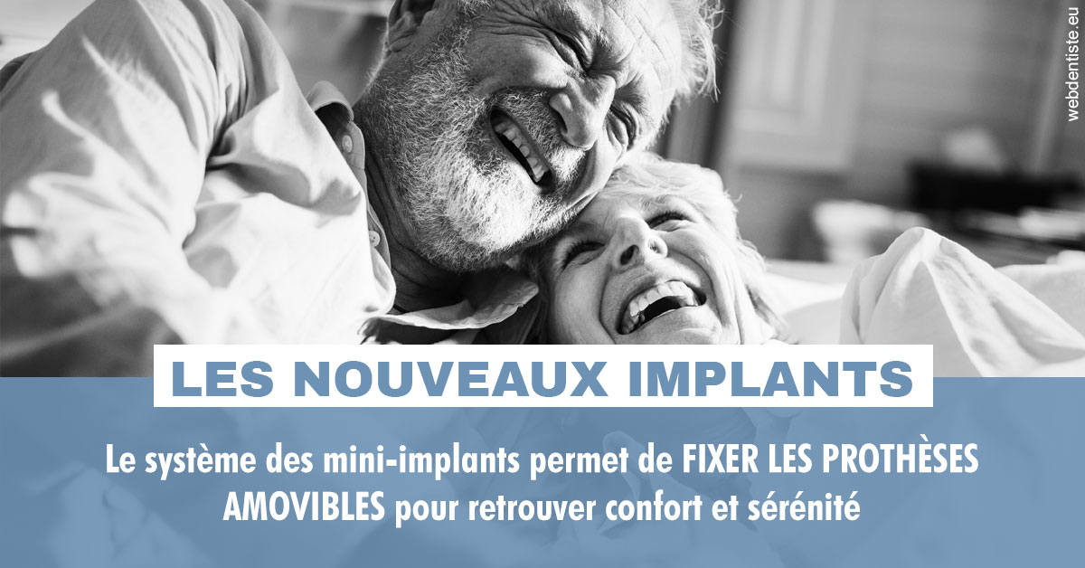 https://dr-gefflot-maxence.chirurgiens-dentistes.fr/Les nouveaux implants 2