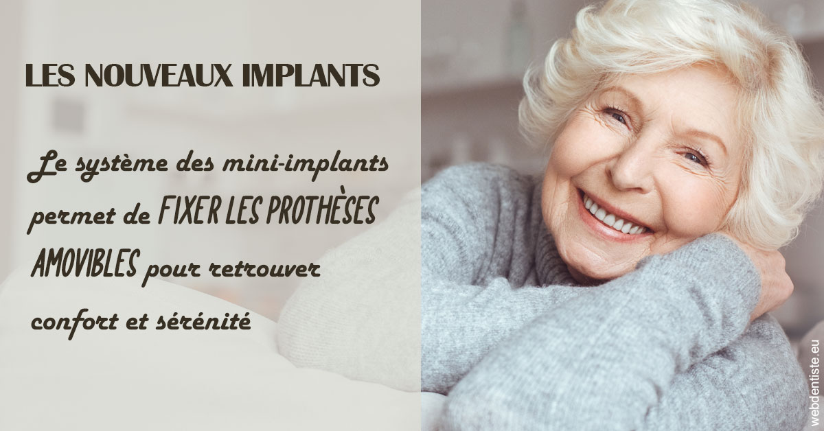 https://dr-gefflot-maxence.chirurgiens-dentistes.fr/Les nouveaux implants 1