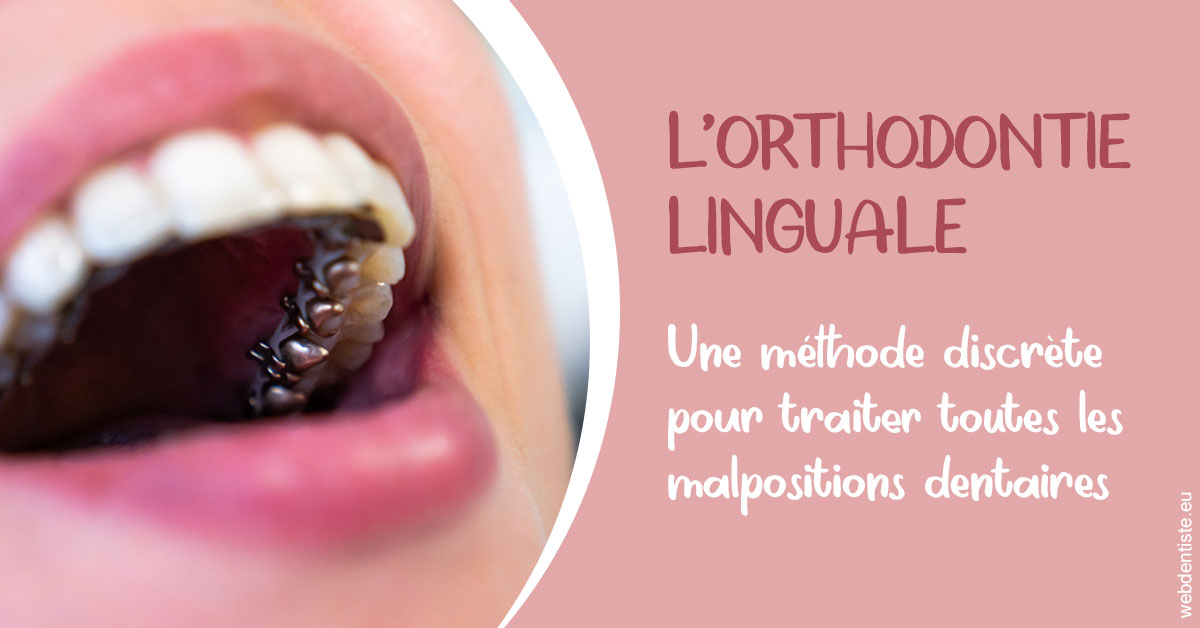 https://dr-gefflot-maxence.chirurgiens-dentistes.fr/L'orthodontie linguale 2