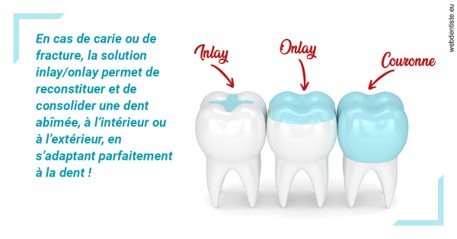 https://dr-gefflot-maxence.chirurgiens-dentistes.fr/L'INLAY ou l'ONLAY