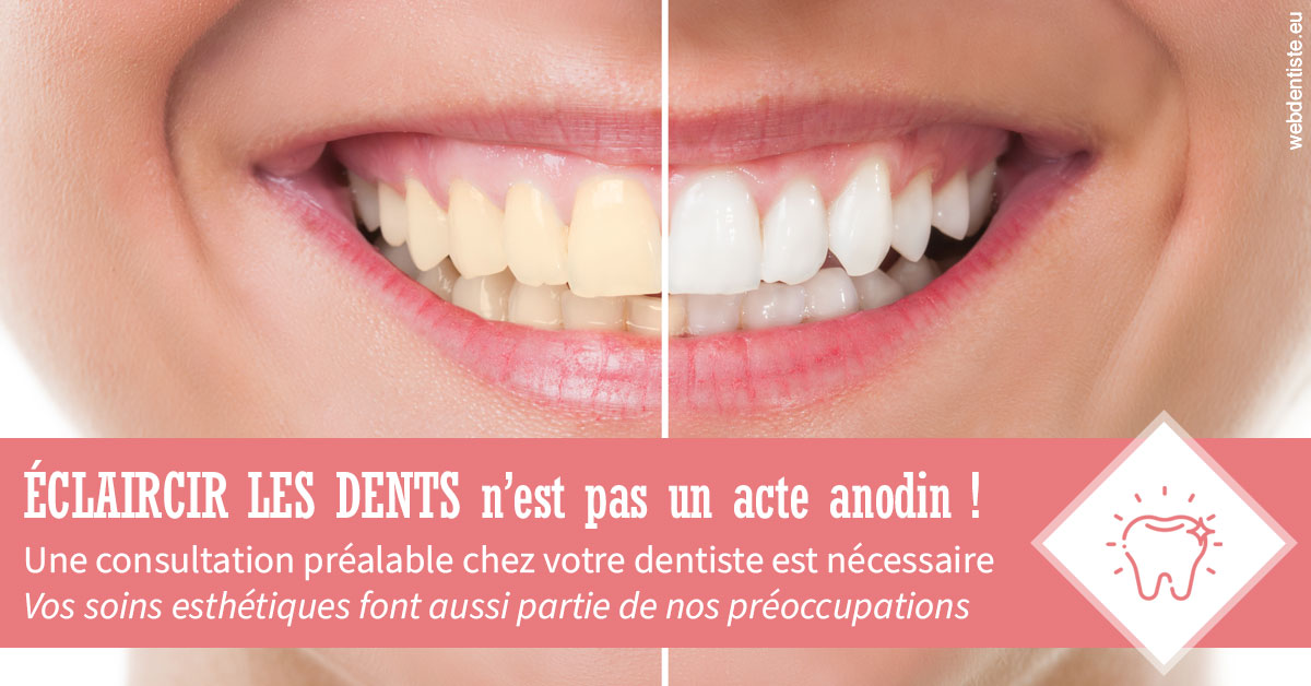 https://dr-gefflot-maxence.chirurgiens-dentistes.fr/Eclaircir les dents 1