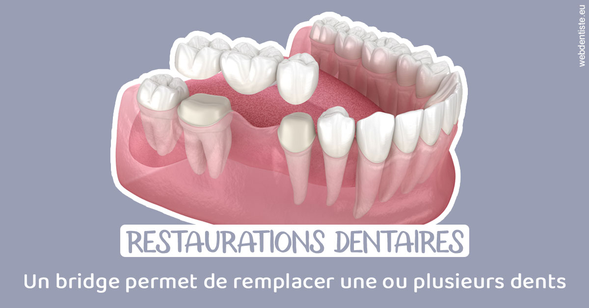 https://dr-gefflot-maxence.chirurgiens-dentistes.fr/Bridge remplacer dents 1