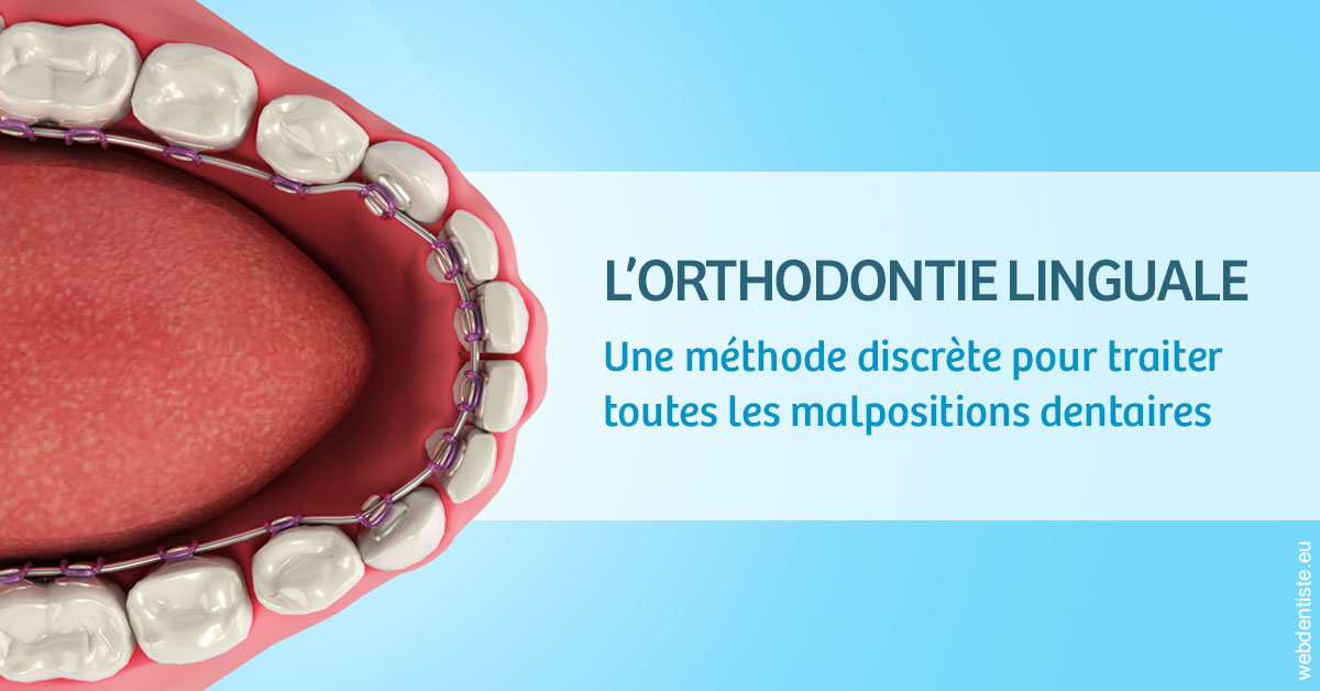 https://dr-gefflot-maxence.chirurgiens-dentistes.fr/L'orthodontie linguale 1