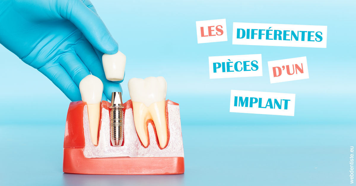 https://dr-gefflot-maxence.chirurgiens-dentistes.fr/Les différentes pièces d’un implant 2