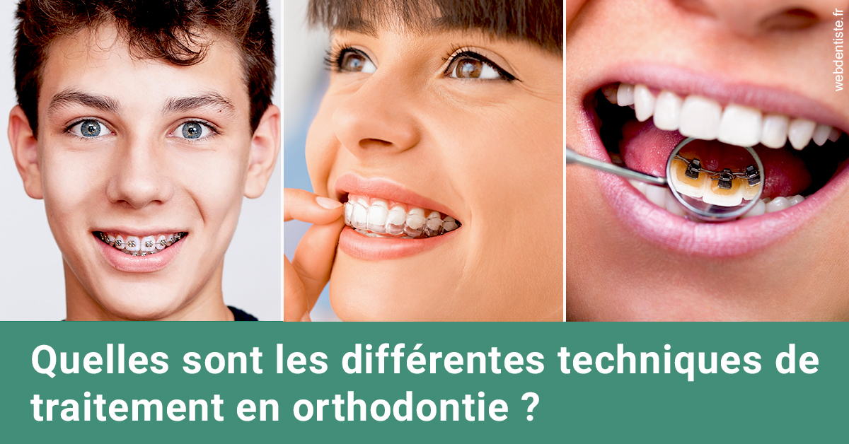 https://dr-gefflot-maxence.chirurgiens-dentistes.fr/Les différentes techniques de traitement 2