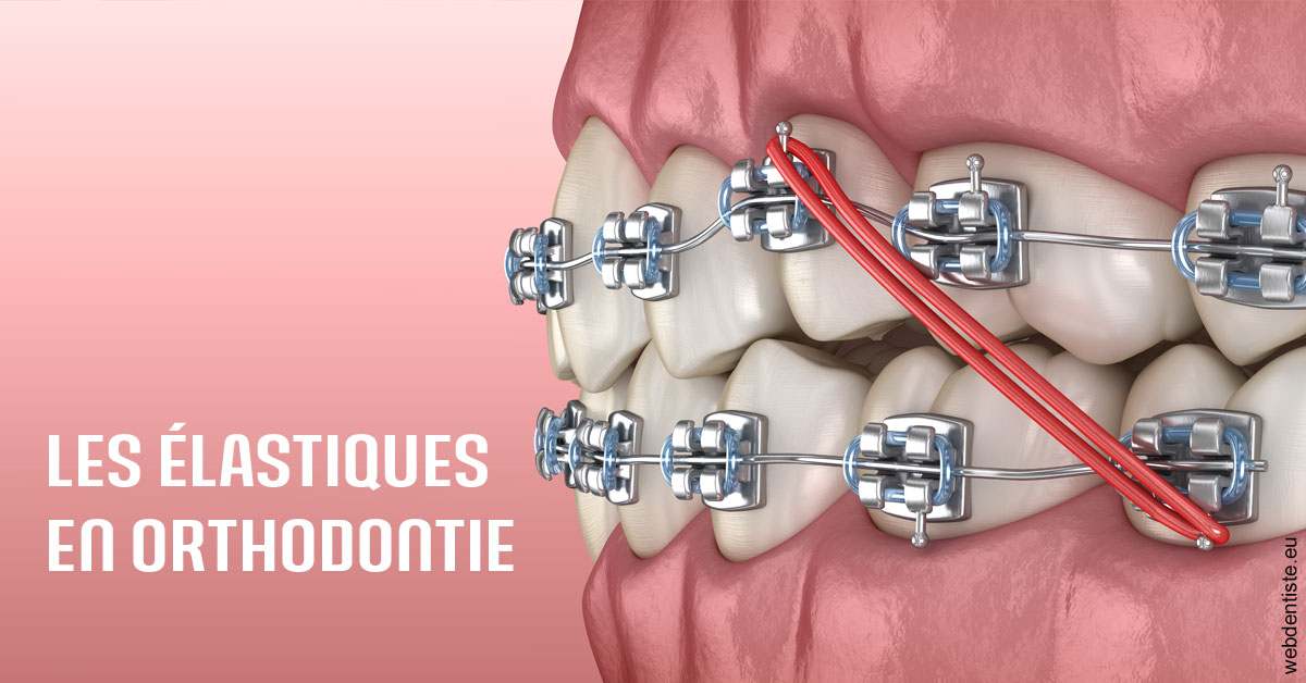 https://dr-gefflot-maxence.chirurgiens-dentistes.fr/Elastiques orthodontie 2