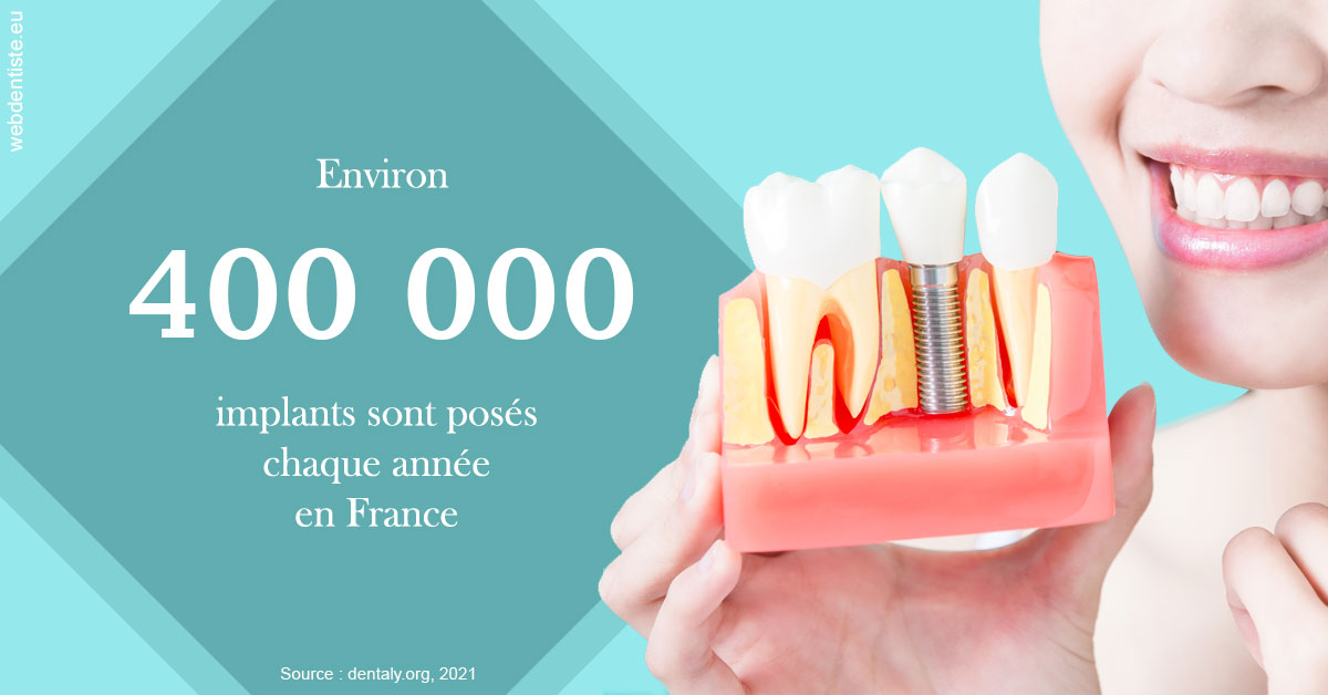https://dr-gefflot-maxence.chirurgiens-dentistes.fr/Pose d'implants en France 2